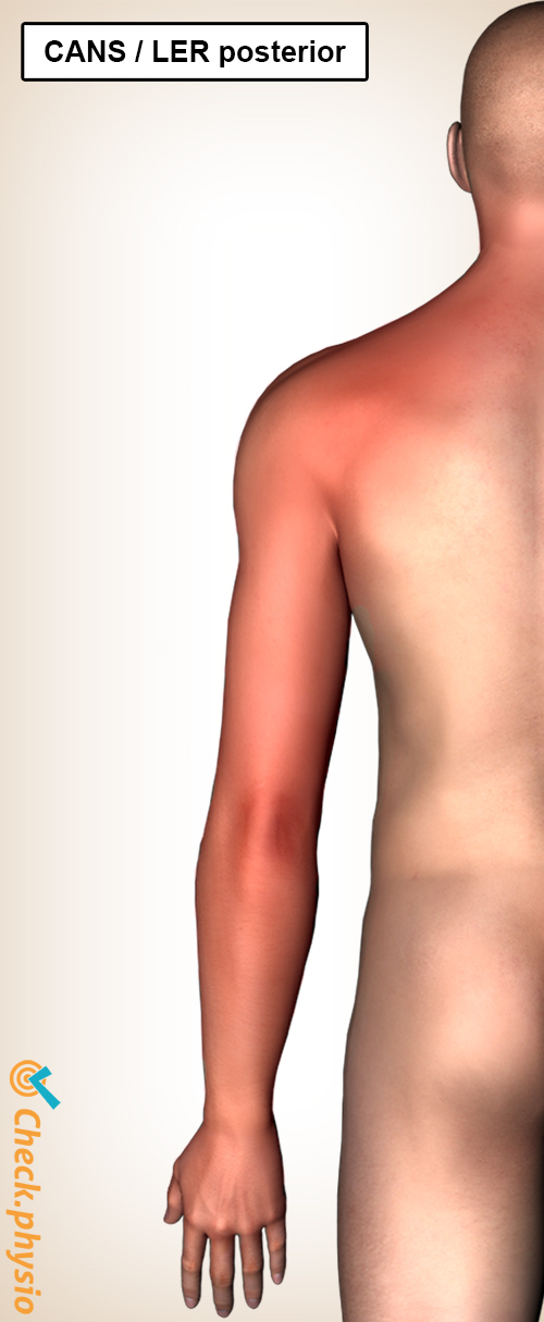 ler rsi anterior